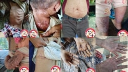 စစ်ဒဏ်သင့် ရခိုင်ပြည်နယ်မှာ ကျန်းမာရေး ပြဿနာတွေနဲ့ကြုံ 