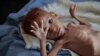 FILE - A severely malnourished boy rests on a hospital bed at the Aslam Health Center, Hajjah, Yemen, Oct. 1, 2018.