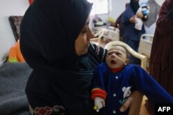 Palestinska beba, koja pati od neuhranjenosti u bolnici u Rafahu, mart 2024.