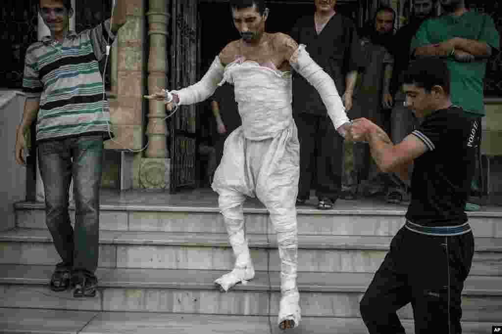 A Syrian man with more than half his body burnt from an air strike leaves a field hospital to go back home at a village turned into a battlefield with government forces in Idlib province, northern Syria, Sept. 22, 2013. 