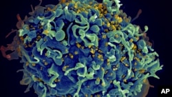 Ljudska ćelija pod napadom virusa HIV (Foto: Seth Pincus, Elizabeth Fischer, Austin Athman/National Institute of Allergy and Infectious Diseases/NIH via AP)