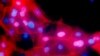 Guidelines Say More Women May Need Breast Cancer Gene Test