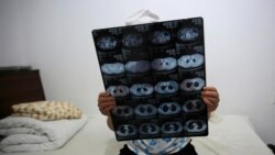 VOA Asia - U.S. medical institutions looking to cure Chinese spying