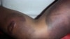Zimbabwe Torture